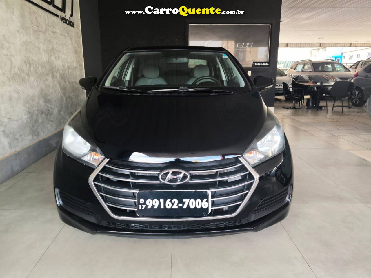 HYUNDAI HB20S 2016/2016 - Loja